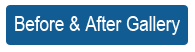DFVF-Button.png